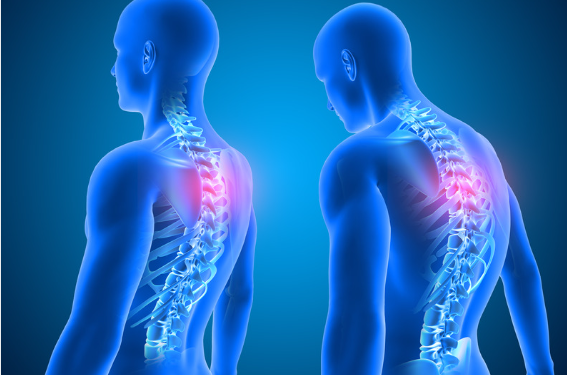 Posture Perfect: Effective Stretches to Stand Tall